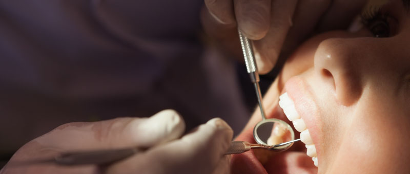 extracción de cordales en Savanna Clínica Odontológica
