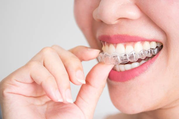 Tratamiento de ortodoncia invisible en Savanna Clínica odontológica